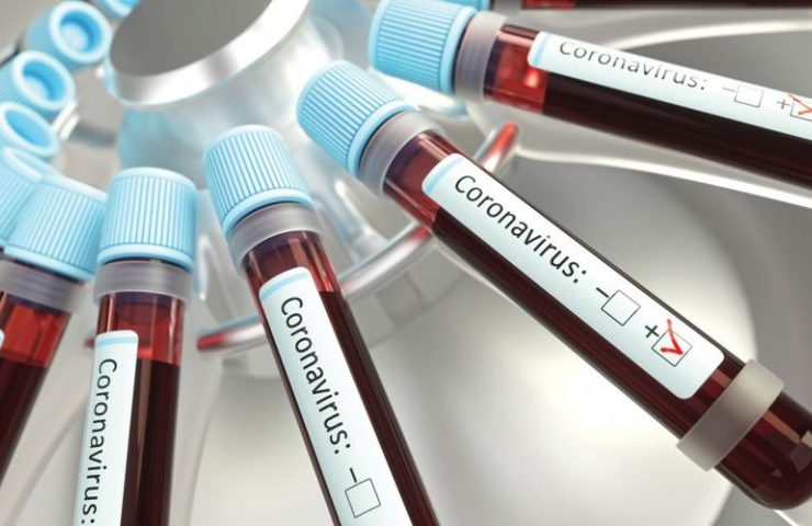 Covid-19 coronavirus